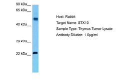 STX10 Rabbit anti-Human, Polyclonal, Novus Biologicals 0.1 mL | Buy Online | Novus Biologicals | Fisher Scientific